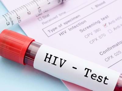 HIV-Schnelltest